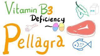 Pellagra (Vitamin B3 Deficiency) - NAD+, NADH, Nicotinic Acid - Diet & Nutrition