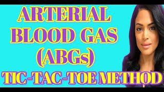 ABGs (Arterial Blood Gas) Tic-Tac-Toe Method for Nursing | NCLEX