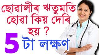 Assamese New Video / assamese health tips and tricks / Assamese Daily motivation story by PapuTips