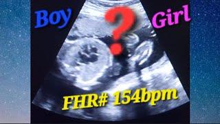 heartbeat ultrasound | heart rate & baby boy/girl | Fetal doppler heartbeat sound | fetal heart rate