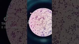 Gram positive cocci identification #bacteria #staphylococcus #microscope