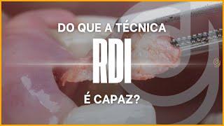 Implantodontia estética não se resume a preencher o gap com biomaterial!