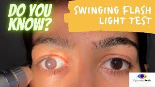 Swinging flash light test II How to examine RAPD II Assess relative afferent pupillary defect