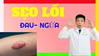 CÁCH TRỊ SẸO LỒI LÂU NĂM| SẸO LỒI GÂY ĐAU- NGỨA| DR.NGỌC