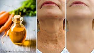 Anti aging magic oil,  This oil will erase all the wrinkles on your face, stronger than Botox