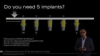 Do you need five implants? | Nobel Biocare