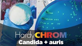 HardyCHROM™ Candida + auris chromogenic media