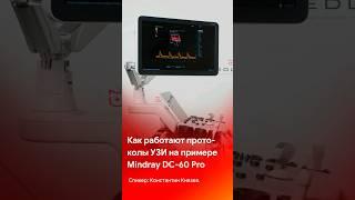 Как работают протоколы УЗИ на примере Mindray DC-60 Pro @medliga #short #shorts #tiktok #узи