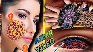 Mox.21 // ASMR Animation:उपचार एवं सफाई// Tick Infected Neck Treatment