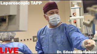 Laparoscopic TAPP LIVE / Лапароскопическая герниопластика