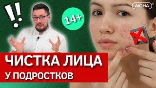 АКНЕ, ПРЫЩИ, ЗАБИТЫЕ ПОРЫ у подростков 14+  | Особенности чистки лица