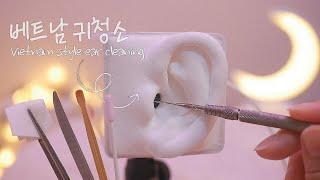[ASMR] Vietnam Style Ear Cleaning Real shaving, cleaning, disinfection (No Talking)