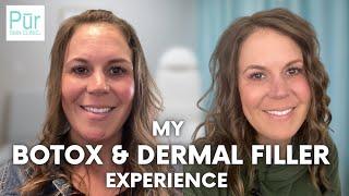 MY BOTOX & DERMAL FILLER EXPERIENCE | Dermal Fillers + Botox Before and After | PUR Skin Clinic