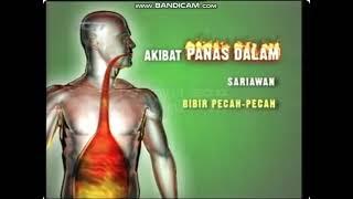 Iklan Larutan Penyegar Kaki Tiga - Akibat Panas Dalam (2009) @ RCTI, TPI, Indosiar, Trans TV, & ANTV