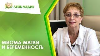  Миома матки и беременность