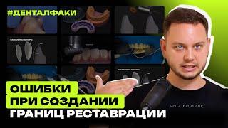 #ДенталФаки - Ошибки при создании границ реставрации