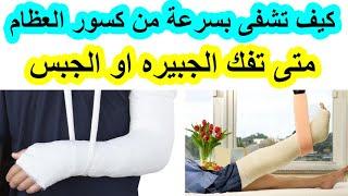 كيف تسرع شفاء كسور العظام