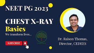 Understanding Basics of Chest X-Ray : NEET MDS 2023 Recall Questions Based.