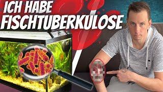 KRANKHEIT aus Aquarium - Ich habe mich mit FISCHTUBERKULOSE infiziert!