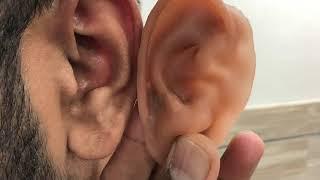 artificial ear or silicon ear with microtia