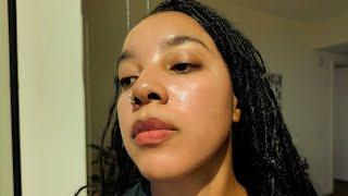 How I Cleared My Acne, Dark Spots & Hyperpigmentation - Glass Skin Routine