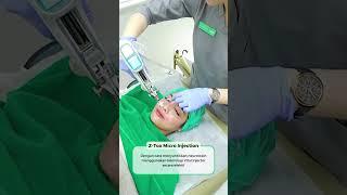 Buktikan hasil nyata Z-tox Micro Injection di seluruh outlet ZAP Clinic