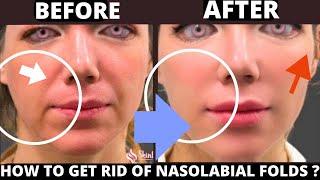 HOW TO GET RID OF NASOLABIAL FOLDS WITH FACE YOGA ? SAGGY SKIN, JOWLS, FOREHEAD, MOUTH LINES, NECK