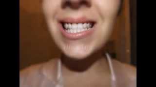 Natural White Teeth With Home Remedies