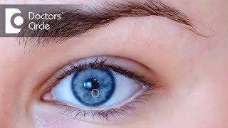 What causes blue shimmer in eyes? - Dr. Elankumaran P