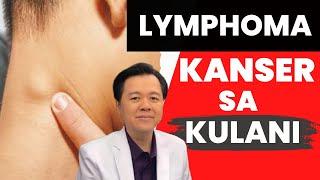 Lymphoma: Kanser sa Kulani - Payo ni Doc Willie Ong #831b
