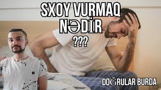 Suxoy vurmaq nədir