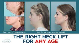 Neck Lift Techniques for Any Age or Skin Type