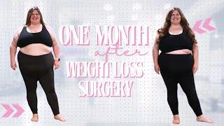 How much weight lost One month after Weight Loss Surgery? | One Month Post Duodenal Switch