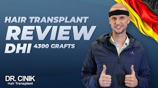 Dr.Cinik Hair Transplant Review | DHI | 4300 Grafts