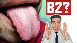 Uncover the Shocking Symptoms of Vitamin B2 Deficiency!