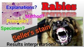 Rabies virus infection/Rabies identification/Seller's stain/Negri bodies/STAR LABORATORY