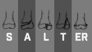 Salter Harris Fracture Classification - MEDZCOOL