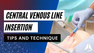 Central Venous Catheter (CVC) Demonstration | #anesthesiology #anesthesia #anaesthesia #cvc