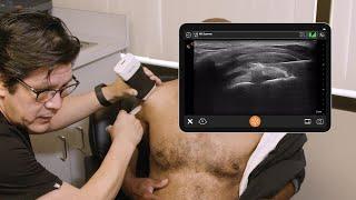 Subacromial Bursa Injection - Ultrasound Scanning Technique