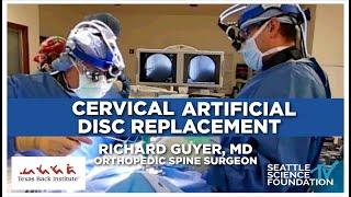 Cervical Artificial Disk Replacement - Richard Guyer, M.D.