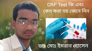 CRP Test কেন করা হয় এর বিস্তারিত আলোচনা