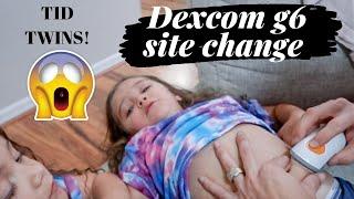 DEXCOM G6 Insertion On Belly | 3 Year Old T1D twins