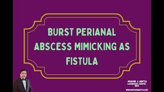 BURST PERIANAL ABSCESS MIMICKING AS FISTULA