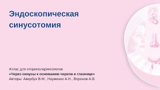 Эндоскопическая синусотомия. Операцию проводит Алексей Владимирович Воронов.