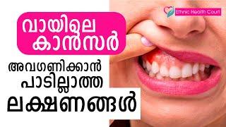 വായിലെ കാൻസർ - ശ്രദ്ധിക്കാതെ പോകുന്നു ഒടുവിൽ മാരകമാകുന്നു | Symptoms of mouth cancer