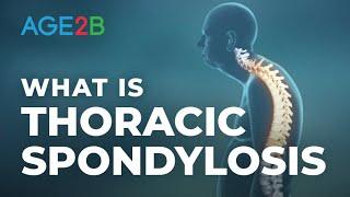 What Is Thoracic Spondylosis? | Spondylolysis & Spondylolisthesis | Definition