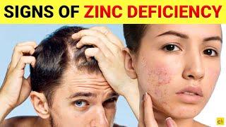 Do you know these 7 Shocking signs of Zinc Deficiency - Credihealth