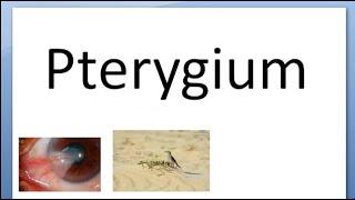 Ophthalmology 096 a Pterygium What is in Eye Type Part Fuch Spots Islet of Vogt Stocker line