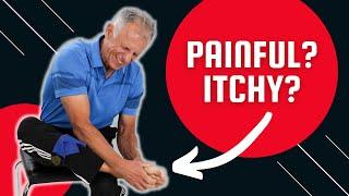 How to Relieve/Stop Painful, Itchy debilitating FOOT PAIN ( 3 Steps)