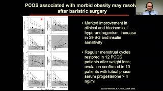 BOMSS Educational Webinar - Alexander Miras